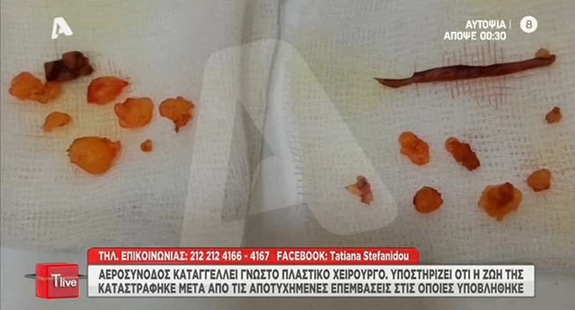 λιπος