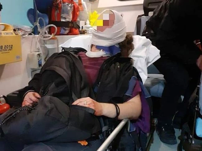 Τραυματισμένη γυναίκα