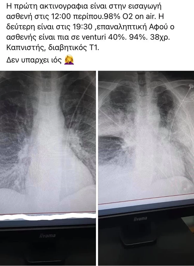 ΑΚΤΙΝΟΓΡΑΦΙΕΣ
