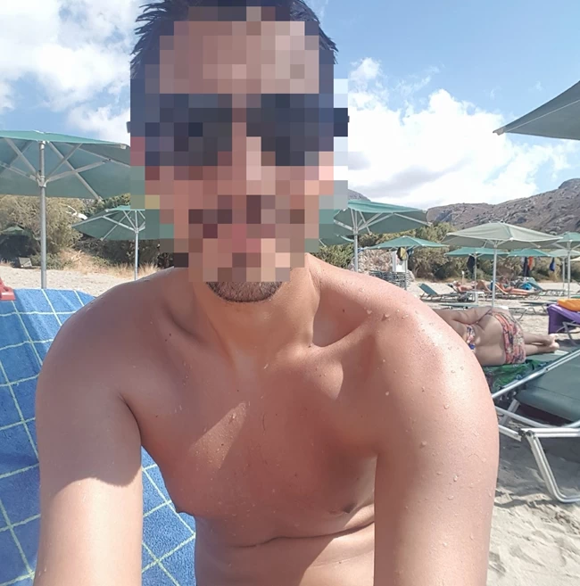 ΚΟΛΩΝΟΣ 34ΧΡΟΝΟΣ
