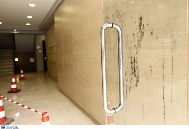 Καλλιθέα: Εχασε το ένα της μάτι η γυναίκα που δέχθηκε επίθεση με οξύ από ερωτική αντίζηλο