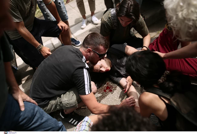 Θεσσαλονίκη: Επεισόδια στο Βιολογικό του ΑΠΘ - Τραυματίστηκε φοιτητής στο κεφάλι (ΦΦΩΤΟ & ΒΙΝΤΕΟ) Επεισόδια ΑΠΘ