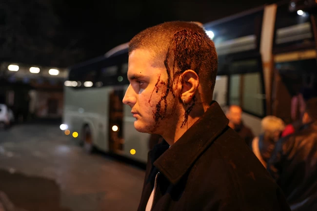 Πρώτο θέμα στα διεθνή ΜΜΕ η τραγωδία στα Τέμπη: "Το χειρότερο σιδηροδρομικό δυστύχημα που έχει σημειωθεί ποτέ στην Ελλάδα"