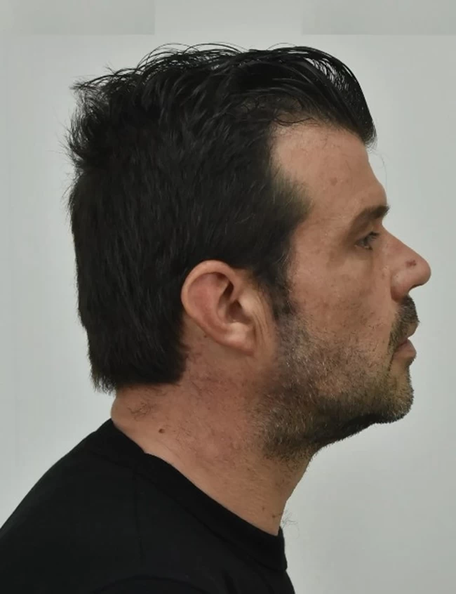 ΛΗΣΤΗΣ ΠΑΤΙΝΙ