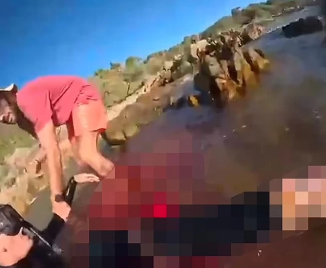 Του επιτέθηκε καρχαρίας και τον άφησε χωρίς πόδι - Έβγαλε βίντεο ενώ ήταν αιμόφυρτος: "Δεν πίστευα ότι θα ζούσα"