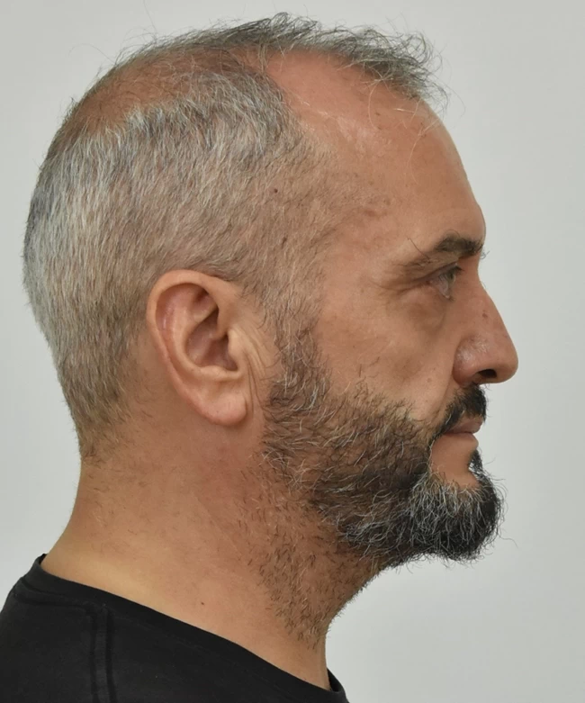 ΗΛΙΑΣ ΜΙΧΟΣ