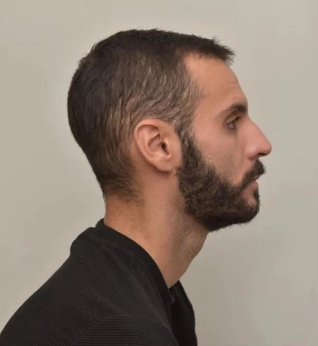 ΑΓΡΙΝΙΟ ΠΟΔΟΣΦΑΙΡΙΣΤΗΣ ΑΣΕΛΓΕΙΑ