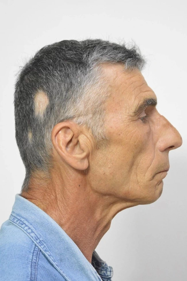 ΑΣΕΛΓΕΙΑ ΠΑΤΡΑ