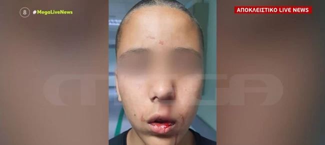 Νέα Κηφισιά: Σοκάρει βίντεο με ξυλοδαρμό 13χρονου - 16χρονος τον χτυπά με κλωτσιές και μπουνιές στον δρόμο