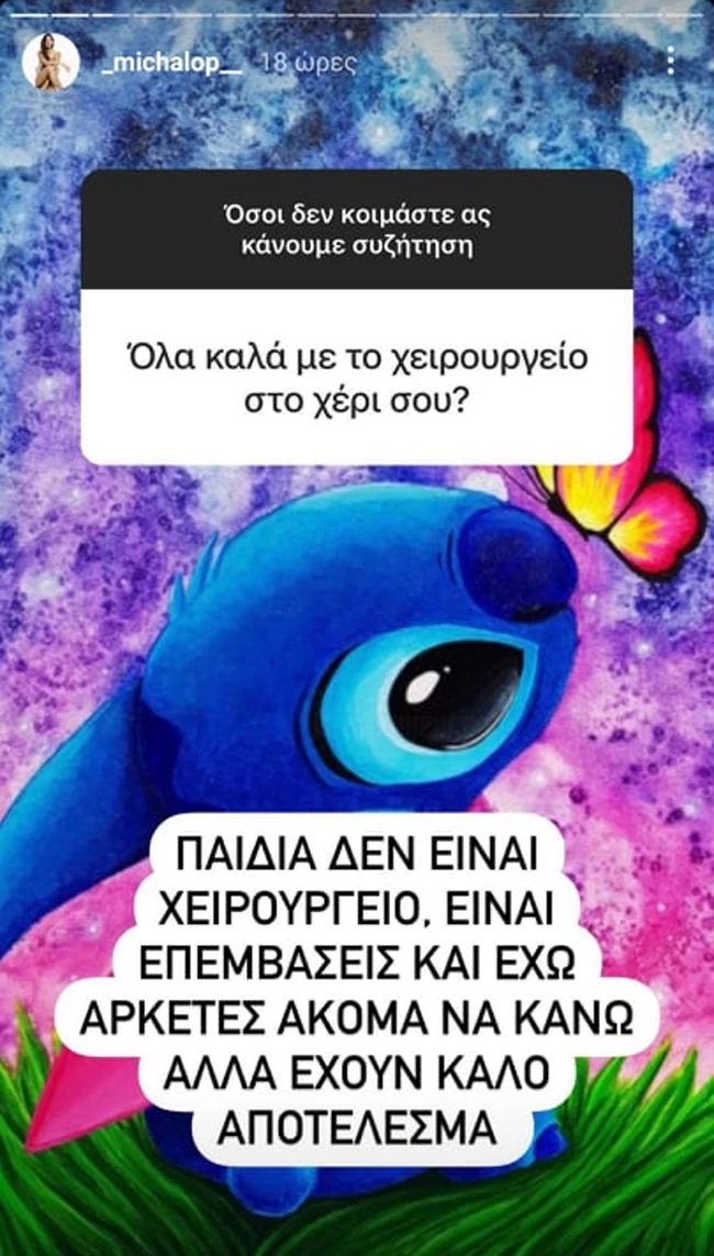 Μαρία Μιχαλοπούλου εξηγεί το πρόβλημα της υγείας της: Ο γιατρός μου κάνει ενέσεις για να ατροφήσουν οι φλέβες
