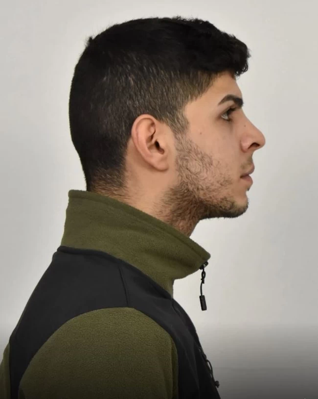 ΛΗΣΤΗΣ ΜΕΤΡΟ