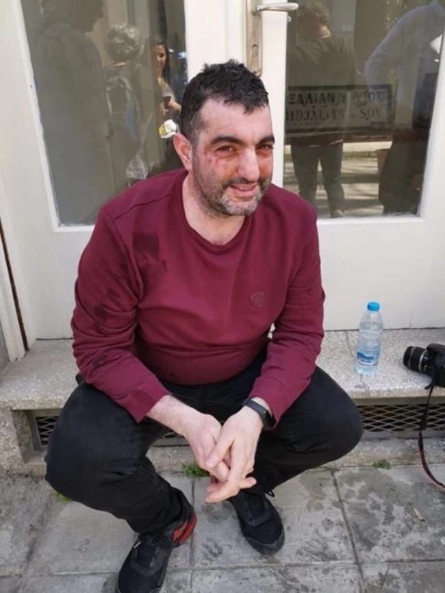Ένταση σε συγκέντρωση στο οδόφραγμα της οδού Λήδρας στην Κύπρο