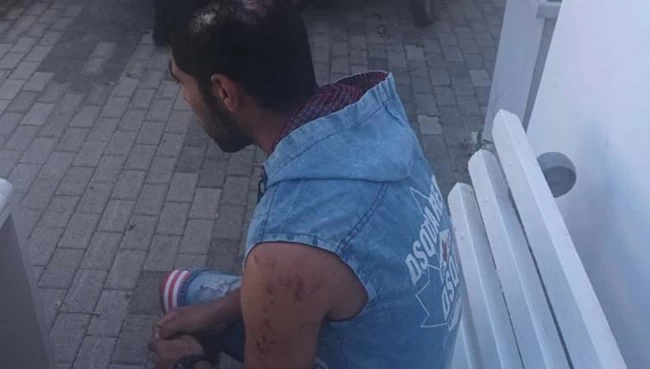 Κρήτη: Εικόνες σοκ από τον ξυλοδαρμό εργαζόμενου με αλυσίδα, επειδή ζήτησε από τον εργοδότη τα δεδουλευμένα του