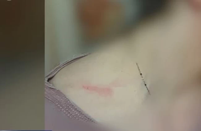ξυλοδαρμός 29χρονης