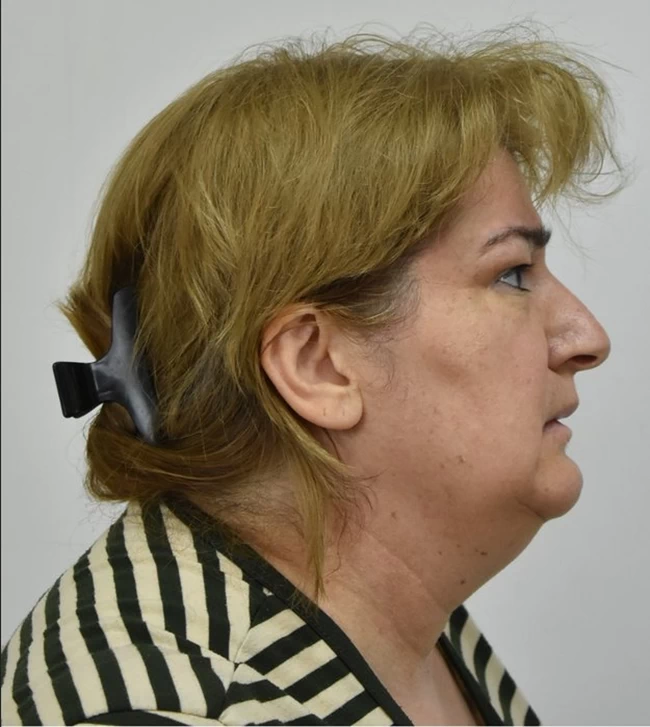 Αυτή είναι η γυναίκα "αράχνη" από τη Γεωργία: Νάρκωνε με υπνωτικά χάπια ηλικιωμένους και τους έκλεβε (ΦΩΤΟ) Απατεώνας