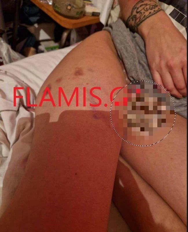ΚΑΚΟΠΟΙΗΣΗ ΠΑΤΡΑ
