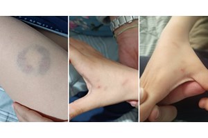 Θεσσαλονίκη: Σχολείο εκκενώθηκε έπειτα από τηλεφώνημα για βόμβα