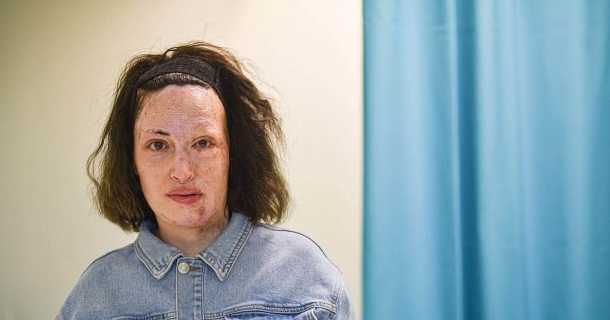 Καπραβέλος για μύκητα Candida Auris: Δεν αποτελεί κίνδυνο για την δημόσια υγεία, αλλά για τα νοσοκομεία και τις ΜΕΘ