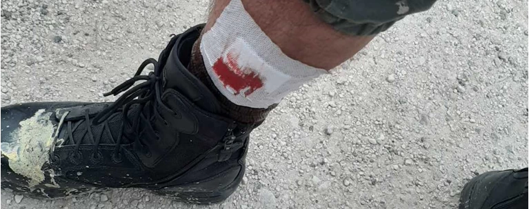τραυματίας αστυνομικός