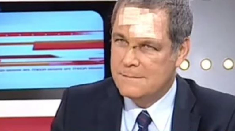 Ο Τζήμερος με γάζες και τσιρότο στην πρώτη εμφάνιση μετά το ατύχημα