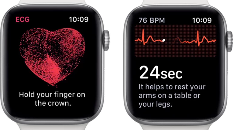 Apple Watch: Από σήμερα Ηλεκτροκαρδιογράφημα και ειδοποίηση για Μαρμαρυγή