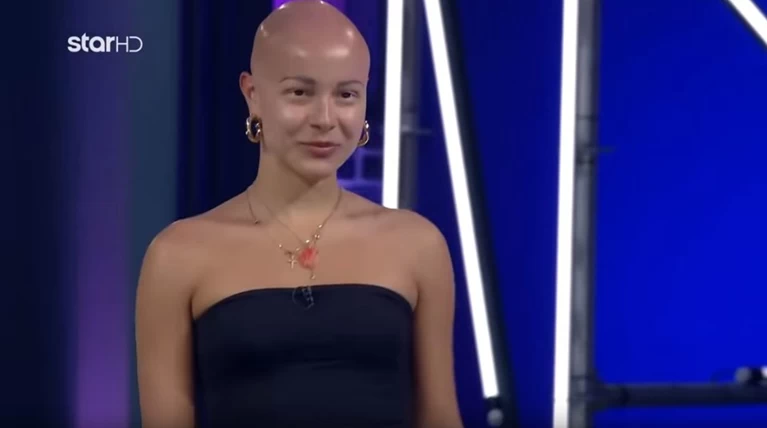 Η πανέμορφη Λυδία στο GNTM: Στο σχολείο φορούσα περούκες, ήταν δύσκολα