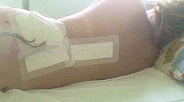 H συγκλονιστική εξομολόγηση μιας ελληνίδας για τη μάχη με τον καρκίνο