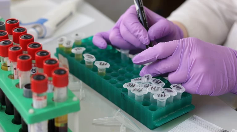ΚΕΕΛΠΝΟ: Οι περισσότερες διαγνώσεις HIV στους 30-39 ετών