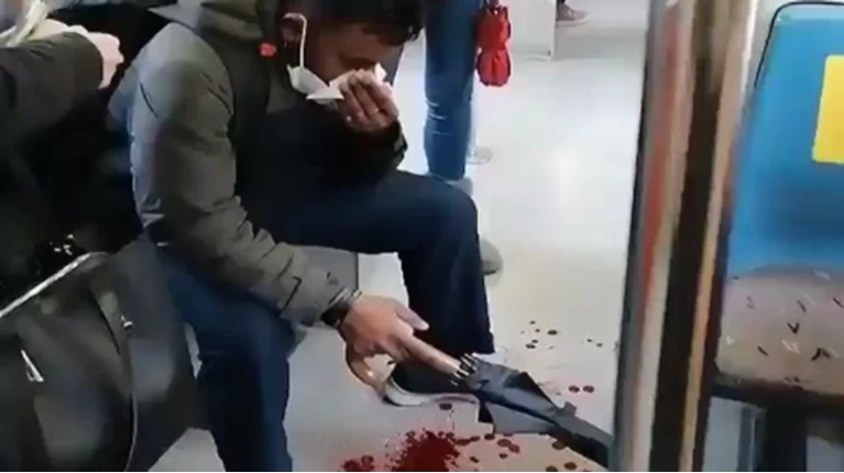 ΡΑΤΣΙΣΤΙΚΗ ΕΠΙΘΕΣΗ